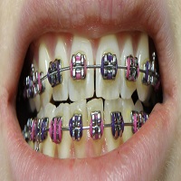 Orthodontics